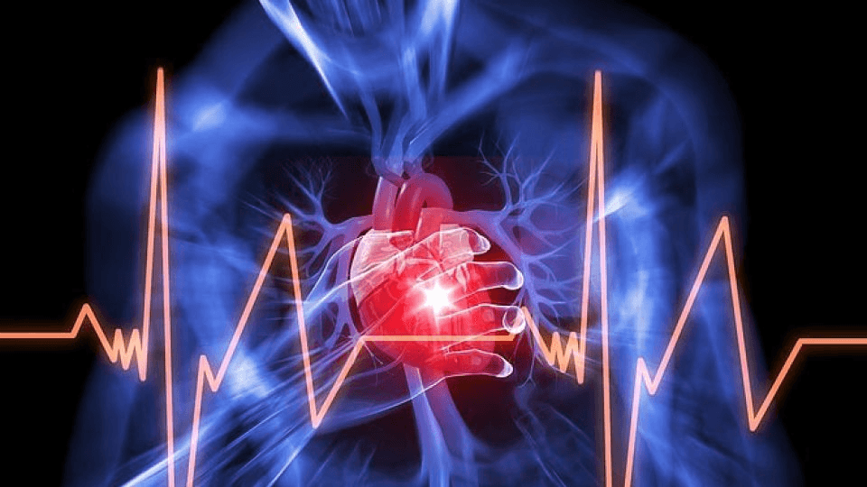 Silent Heart Attack: A Rising Concern