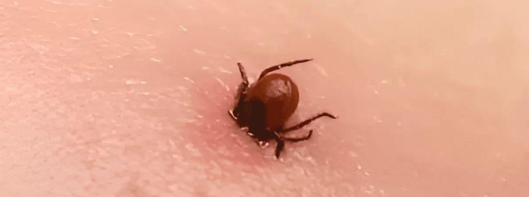 Deadly Congo Fever virus in Gujarat